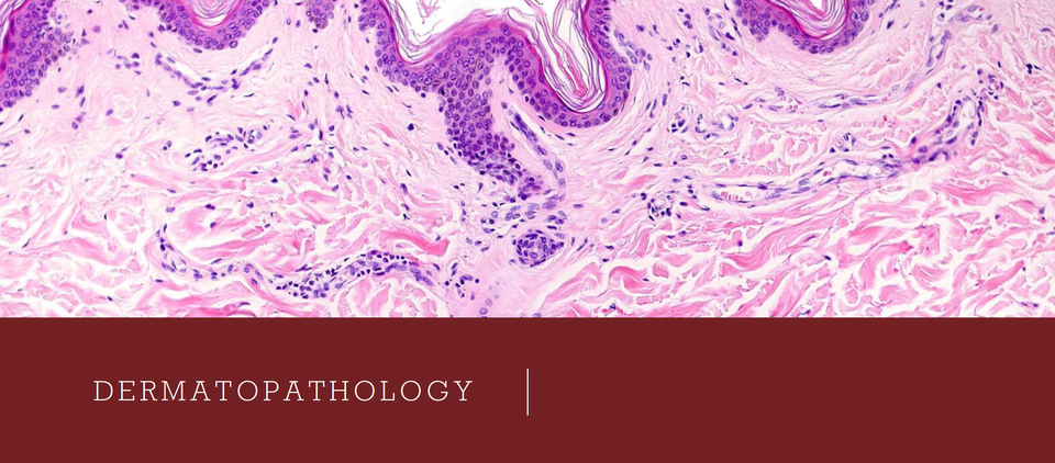 Join the monthly Dermatopathology Evening next Monday (13/02/2023) from 19 to 20h on Teams!